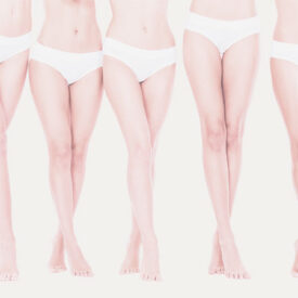 five woman with think legs wearing white underwear pose for photo Dr. Christine Rodgers Denver Plastic Surgery