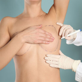 Realistic Expectationsbreast augmentation